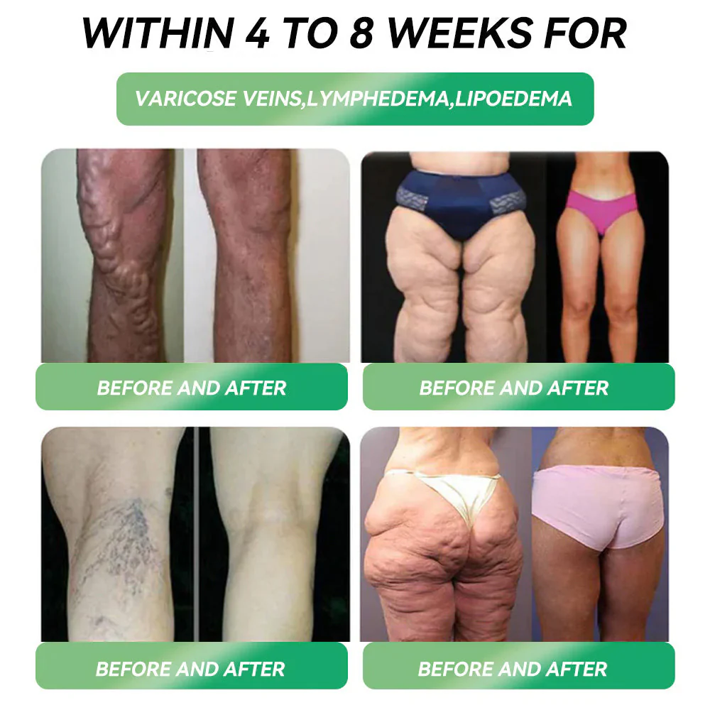 𝑂𝑓𝑓𝑖𝑐𝑖𝑎𝑙 𝑆𝑡𝑜𝑟𝑒 | 𝐂𝐥𝐞𝐚𝐧𝐬𝐢𝐧𝐠®👨‍⚕️ GLP-1 Oral Weight Loss Solution 💎 Just one week, visible results in 7 days Suitable for skin folds, wrinkles, obesity, cardiovascular health, diabetes, sleep apnea, joint issues, and more - Image 4