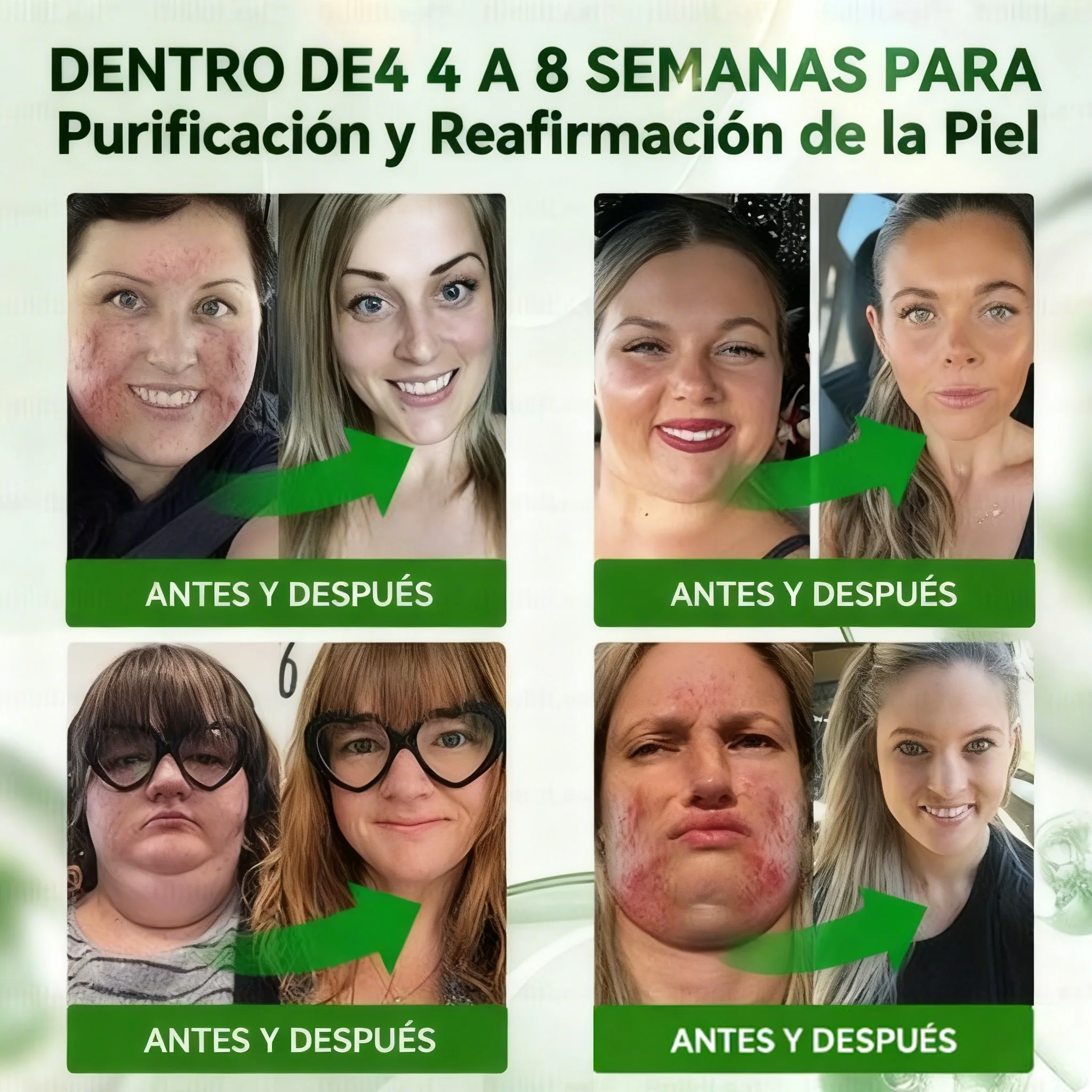 Cleansing® 𝑮𝑳𝑷-1 𝑮𝒖𝒕 𝑪𝒍𝒆𝒂𝒏𝒔𝒆 𝒂𝒏𝒅 𝑺𝒍𝒊𝒎 𝑺𝒖𝒑𝒑𝒐𝒓𝒕 𝑭𝒐𝒓𝒎𝒖𝒍𝒂 (𝐎𝐧𝐜𝐞 𝐚 𝐝𝐚𝐲, 𝐫𝐞𝐬𝐮𝐥𝐭𝐬 𝐢𝐧 𝟕 𝐝𝐚𝐲𝐬) 𝑾𝒊𝒕𝒉 10 𝑩𝒊𝒍𝒍𝒊𝒐𝒏 𝑪𝑭𝑼 𝑨𝒄𝒕𝒊𝒗𝒆 𝑷𝒓𝒐𝒃𝒊𝒐𝒕𝒊𝒄𝒔, 𝑺𝒖𝒑𝒑𝒐𝒓𝒕𝒔 𝒘𝒆𝒊𝒈𝒉𝒕 𝒎𝒂𝒏𝒂𝒈𝒆𝒎𝒆𝒏𝒕, 𝒉𝒆𝒂𝒓𝒕 𝒉𝒆𝒂𝒍𝒕𝒉, 𝒅𝒊𝒂𝒃𝒆𝒕𝒆𝒔, 𝒈𝒖𝒕 & 𝒘𝒐𝒎𝒆𝒏'𝒔 𝒉𝒆𝒂𝒍𝒕𝒉, 𝒇𝒊𝒓𝒎𝒊𝒏𝒈 𝒔𝒌𝒊𝒏,𝒘𝒉𝒊𝒍𝒆 𝒔𝒆𝒂𝒔𝒐𝒏𝒂𝒍 𝒊𝒎𝒎𝒖𝒏𝒆 𝒔𝒖𝒑𝒑𝒐𝒓𝒕 - Image 5
