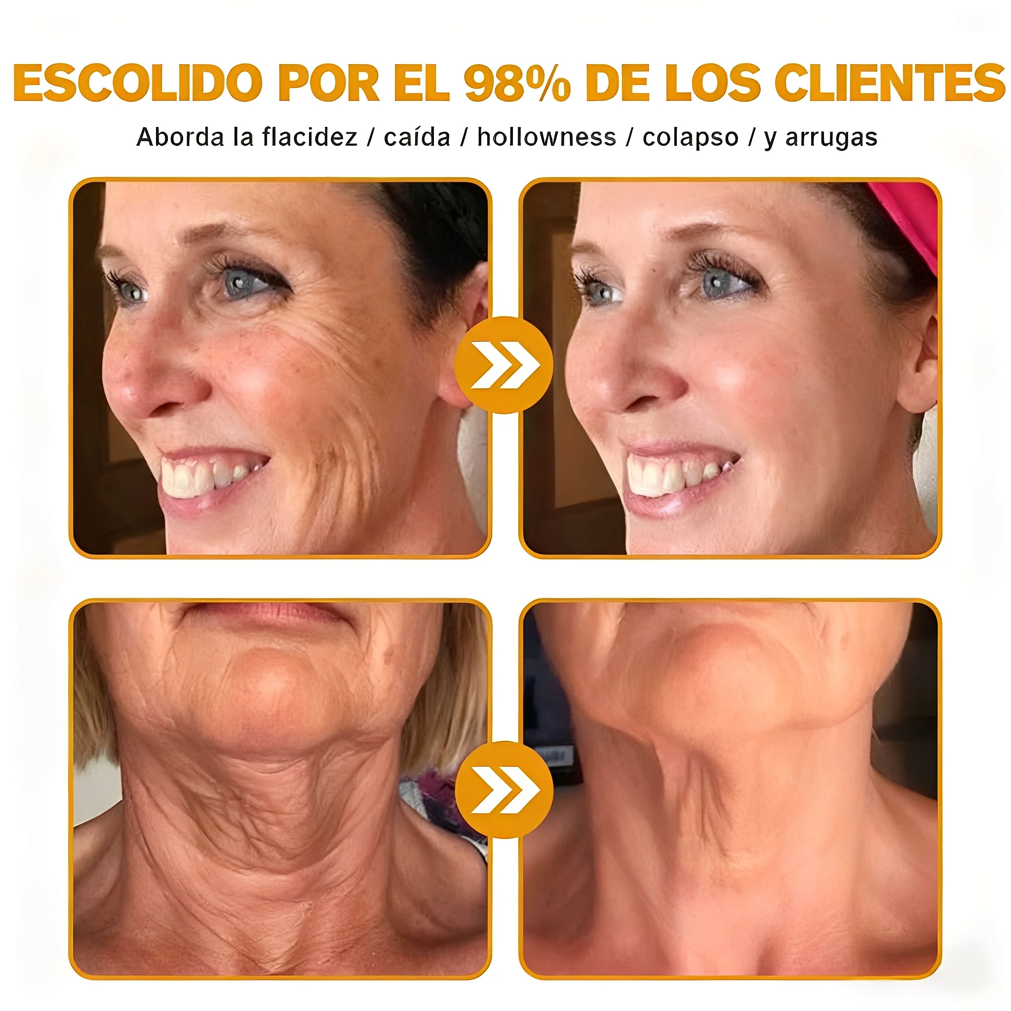 Crema Cleansing® para eliminar arrugas con veneno de abeja y botox (fabricada y enviada desde EE. UU.) - Image 7