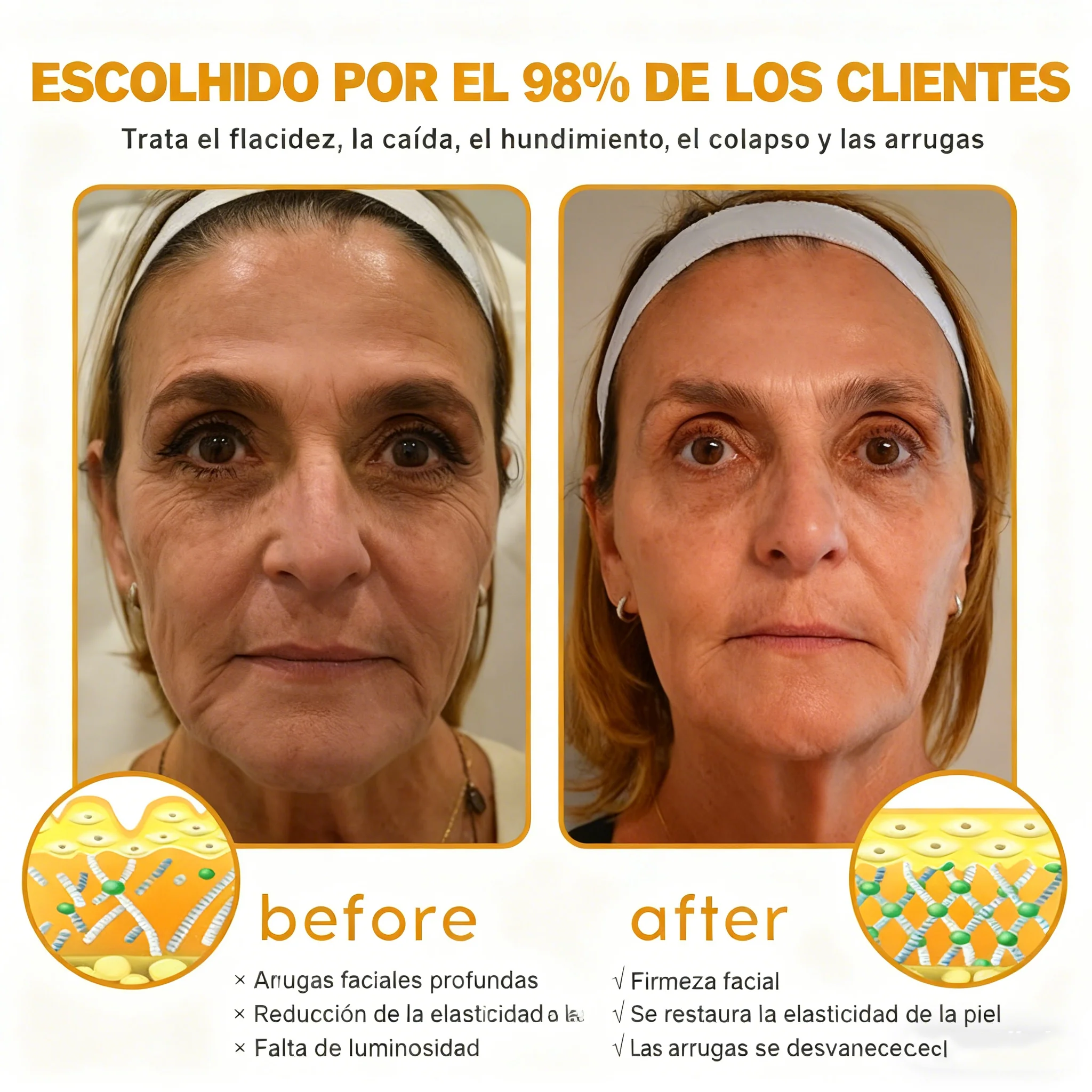 Crema Cleansing® para eliminar arrugas con veneno de abeja y botox (fabricada y enviada desde EE. UU.) - Image 9