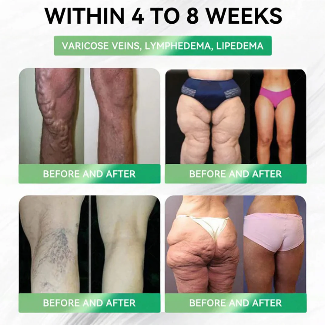 𝑪𝒍𝒆𝒂𝒏𝒔𝒊𝒏𝒈® 𝑮𝑳𝑷-1 8 𝒆𝒏 1 𝑭𝒊𝒕 & 𝑽𝒊𝒕𝒂𝒍 (𝒔𝒐𝒍𝒐 𝒖𝒏𝒂 𝒗𝒆𝒛 𝒂𝒍 𝒅𝒊́𝒂, 𝒄𝒂𝒎𝒃𝒊𝒐𝒔 𝒗𝒊𝒔𝒊𝒃𝒍𝒆𝒔 𝒆𝒏 7 𝒅𝒊́𝒂𝒔) √ 𝑷𝒂𝒓𝒂 𝒐𝒃𝒆𝒔𝒊𝒅𝒂𝒅, 𝒔𝒂𝒍𝒖𝒅 𝒄𝒂𝒓𝒅𝒊𝒐𝒗𝒂𝒔𝒄𝒖𝒍𝒂𝒓, 𝒅𝒊𝒂𝒃𝒆𝒕𝒆𝒔, 𝒂𝒑𝒏𝒆𝒂 𝒅𝒆𝒍 𝒔𝒖𝒆𝒏̃𝒐, 𝒔𝒂𝒍𝒖𝒅 𝒊𝒏𝒕𝒆𝒔𝒕𝒊𝒏𝒂𝒍, 𝒑𝒓𝒐𝒃𝒍𝒆𝒎𝒂𝒔 𝒂𝒓𝒕𝒊𝒄𝒖𝒍𝒂𝒓𝒆𝒔 𝒚 𝒎𝒂́𝒔 - Image 7