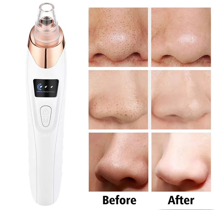 Ultrasonic acne cleaner - Image 3