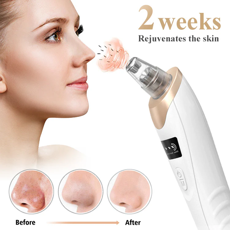 Ultrasonic acne cleaner - Image 8